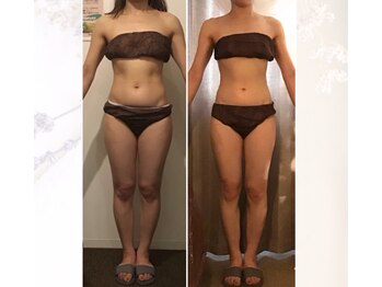 ビープロデュース 国分寺店(B' PRODUCE)/ビフォーアフター