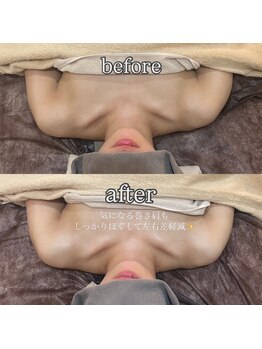 リラ(Lilas)/デコルテハンドで巻き肩ケア