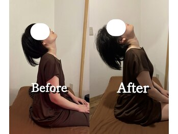 黒田鍼灸治療院/首の可動域と小顔