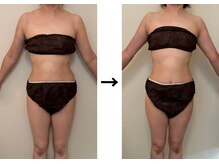 ドクターエイジレス(DR.AGELESS)/筋膜美容整体コース1回