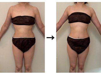 ドクターエイジレス(DR.AGELESS)/筋膜美容整体コース1回