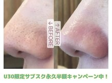 シロ(CHILO)の雰囲気(U30限定!人気のサブスクプランが永久半額♪)