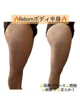 ティパニボーテ(Tipani Beaute')/Reborn痩身