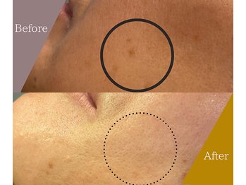 ラディアント 吉祥寺/お肌そのものの変化に驚き！！