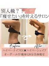 サロン ド ボーテ ラーンジュ 岐阜店(salon de beaut'e L'ange)/ハイパーナイフダイエット痩身