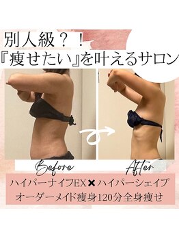 サロン ド ボーテ ラーンジュ 岐阜店(salon de beaut'e L'ange)/ハイパーナイフダイエット痩身