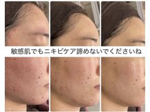 サードプレイス(3rd Place)/2階：エステ症例