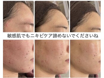 サードプレイス(3rd Place)/2階：エステ症例