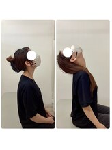 まこと整体院 新鳥栖店/ビフォーアフター（首、肩こり）