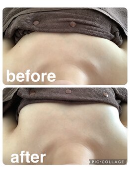 ギンザアール(GINZA R.)/バストケア