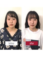 サロンチオリ 烏丸(Salon Chiori)/《30代》左右差スッキリ小顔矯正