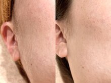 銀座シノ 灯 HANARE(shino)/スキンケア浸透率&お化粧もち◎