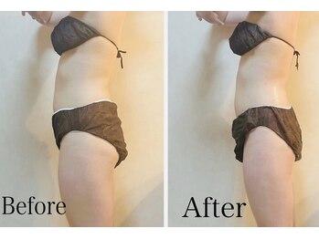 リブ 三軒茶屋(LiB)/本格痩身＆骨格ケア！