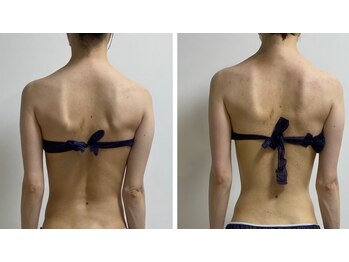 エヌラボ(N.LABO)/肩甲骨剥がし