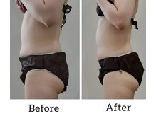 レスプロンディール(Resplendir)/スッキリお腹・美尻ラインに！