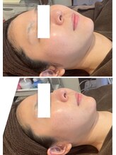 アネル 浦添店(anel)/