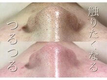 ニコ(Nico)の雰囲気（毛穴改善したい方の綺麗をお手伝いします☆）