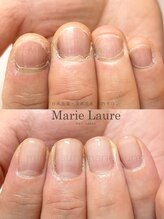 マリーロール 淀屋橋本店(Marie Laure)/自爪育成/深爪矯正/ネイルケア