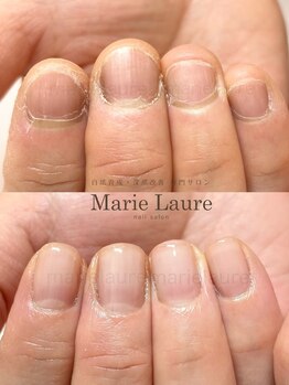 マリーロール 淀屋橋本店(Marie Laure)/自爪育成/深爪矯正/ネイルケア