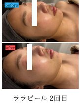 ユフラ(Juhla)/ララピール