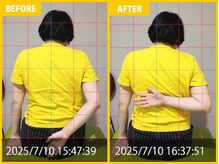 整体院 元 くまなん店/頭痛、首肩の悩み