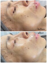 ペリドット(Peridot)/ルナシューネエステ