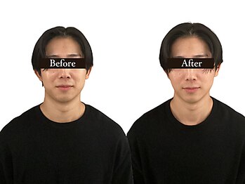 整体と美容鍼 無名/Before&After【心斎橋/南船場】