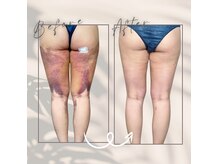 ヴィアス(VIAS)の雰囲気（インディバで術後回復促進・腫れ軽減）