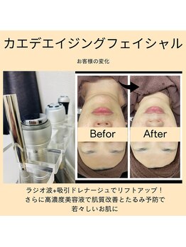 ベルミ―ランド いなげや大和相模大塚/カエデエイジングフェイシャル１