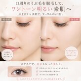 アキュート エ