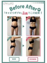 ジュリス(JURIS)/最新痩身マシン・キャビリポプロ