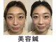 ファン 骨整体 アンド ビューティー ファン 鍼灸(Fan 骨整体&Beauty Fan 鍼灸)の写真