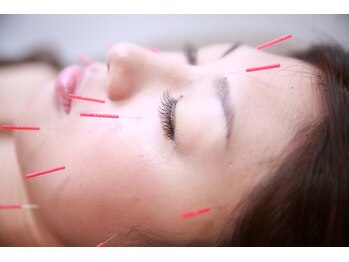 リファイン 月島店(Re:Fine)/美容鍼で肌メンテ、たるみケア