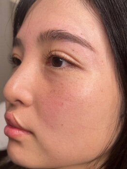 ヨイ(yoi)の写真/★大人気★【高持続×低刺激×お得◎】新発想トリートメントパーマ(アイシャンプー&美容液コーティング込)