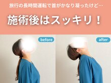 整体院カイト/【首・肩こり】お客様の変化