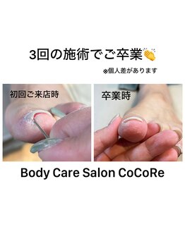 ココリ(CoCoRe)/巻いている爪