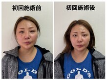 トータルバランス整体院 &nbsp;オレンジ(ORANGE)/小顔矯正/顔の歪み/目の高さ/