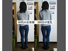 ベルフィオーレ/O脚矯正　40代のお客様