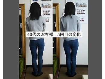 ベルフィオーレ/O脚矯正 40代のお客様