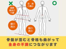 大和屋接骨院/骨盤が歪むと全身が歪みます