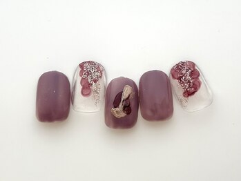 ネイル セルフ脱毛 ソポカロン 阪急桂駅前(sopoca-lon)/Cコース　6500円