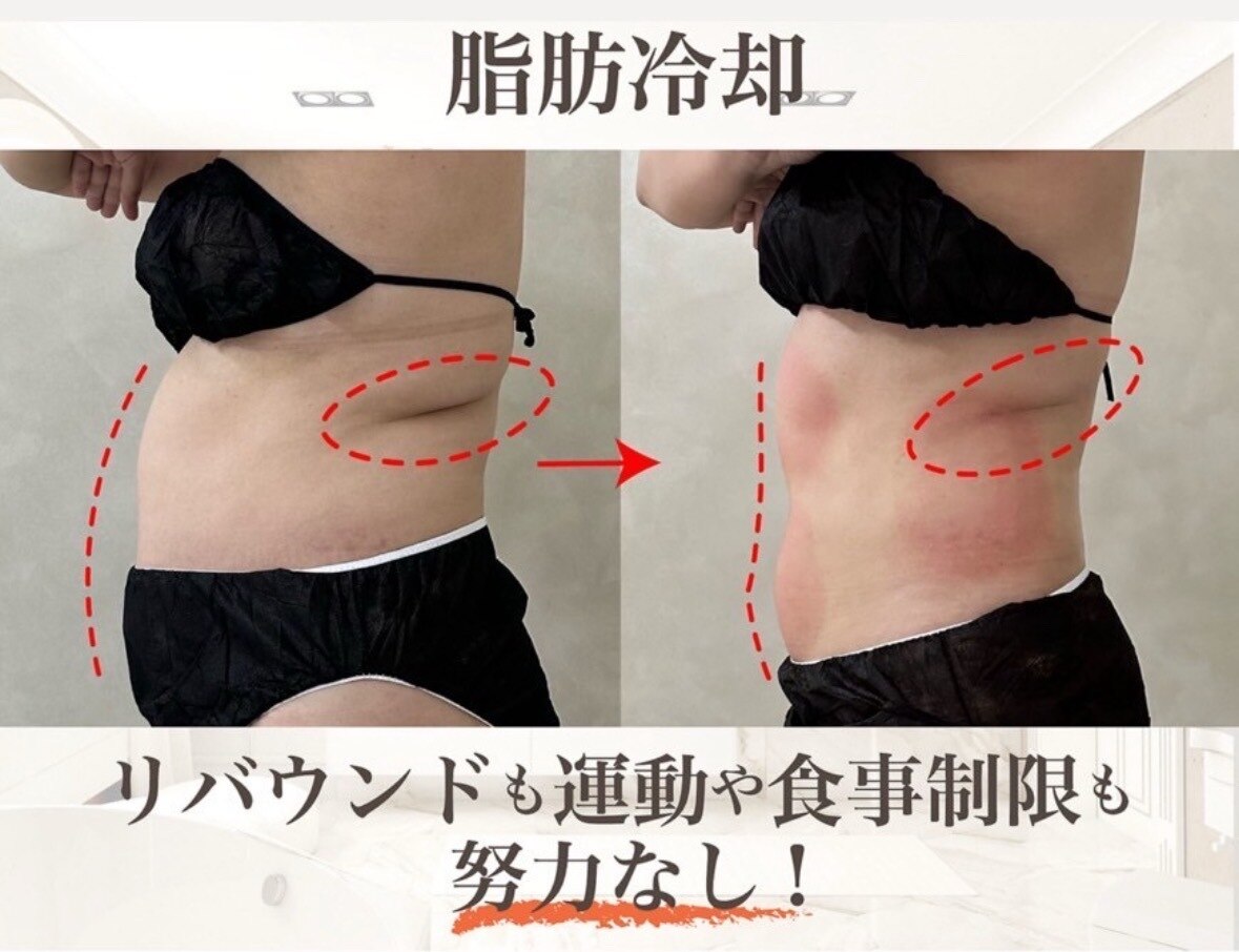島根県で痩身が人気のエステサロン｜ホットペッパービューティー