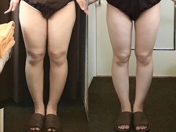 ウェリナ 一宮院/【ダイエットbefore→after】