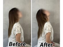 整体家/肩こり、首、頭痛　改善。