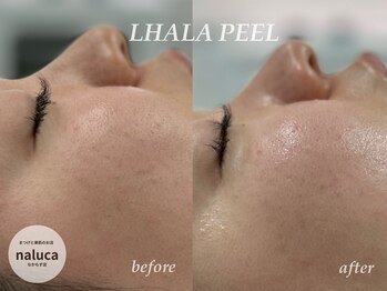 ナルカ(naluca)/【堺市・三国ヶ丘】ララピール