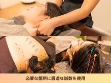 ビアンカ 目黒本院(Bianca)の雰囲気（[目黒/肩こり/マタニティ/骨盤矯正/鍼灸/腰痛/整体/ヘッドスパ]）