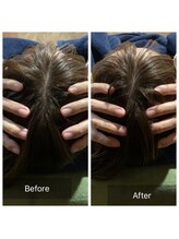 春日部コアラ整体院/Before→After(頭部)