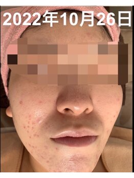 ナヴィータ アオバダイ(Navita AOBADAI)/エンビロン/2ヶ月集中コース