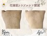【ブライダル】花嫁肌トラブルケア（フェイシャル・ボディ）　体験クーポン