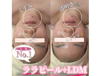 サロン(SALON)/ララピール+LDM